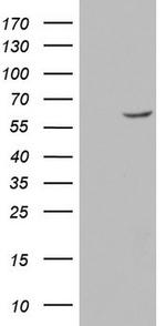 GBA Antibody in Western Blot (WB)