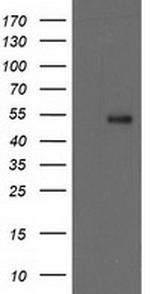 GBA3 Antibody in Western Blot (WB)