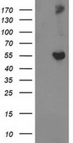 GBA3 Antibody in Western Blot (WB)