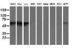 GBA3 Antibody in Western Blot (WB)