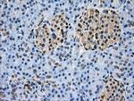 GBE1 Antibody in Immunohistochemistry (Paraffin) (IHC (P))