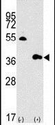 GBL Antibody in Western Blot (WB)