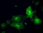 GBP2 Antibody in Immunocytochemistry (ICC/IF)