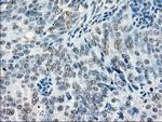 GBP2 Antibody in Immunohistochemistry (Paraffin) (IHC (P))