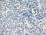 GBP2 Antibody in Immunohistochemistry (Paraffin) (IHC (P))