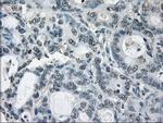 GBP2 Antibody in Immunohistochemistry (Paraffin) (IHC (P))