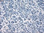GBP2 Antibody in Immunohistochemistry (Paraffin) (IHC (P))