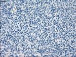 GBP2 Antibody in Immunohistochemistry (Paraffin) (IHC (P))
