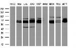 GBP2 Antibody in Western Blot (WB)