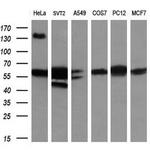GBP2 Antibody in Western Blot (WB)