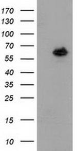 GBP5 Antibody in Western Blot (WB)