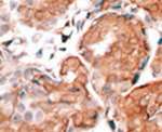 GCAP1 Antibody in Immunohistochemistry (IHC)