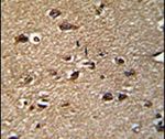 GCAT Antibody in Immunohistochemistry (IHC)