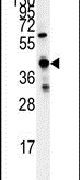 GCAT Antibody in Western Blot (WB)