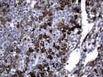GCH1 Antibody in Immunohistochemistry (Paraffin) (IHC (P))