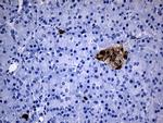 GCH1 Antibody in Immunohistochemistry (Paraffin) (IHC (P))