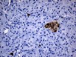 GCH1 Antibody in Immunohistochemistry (Paraffin) (IHC (P))