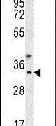 GCH1 Antibody in Western Blot (WB)