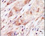 GCK Antibody in Immunohistochemistry (IHC)