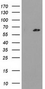 GCKR Antibody in Western Blot (WB)