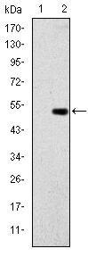 GCK Monoclonal Antibody (4G6)