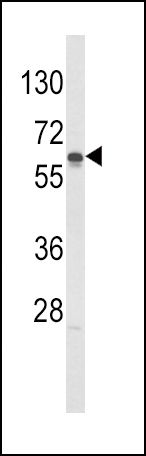 GCK Antibody in Western Blot (WB)