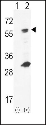 GCK Antibody in Western Blot (WB)