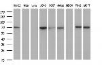 GCLC Antibody in Western Blot (WB)