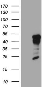 GCM1 Antibody in Western Blot (WB)