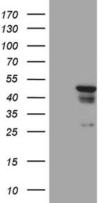 GCM1 Antibody in Western Blot (WB)