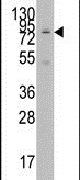 GCN5 Antibody in Western Blot (WB)