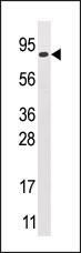 GCS1 Antibody in Western Blot (WB)