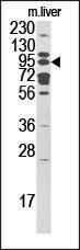 GCS1 Antibody in Western Blot (WB)