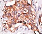 GDF3 Antibody in Immunohistochemistry (IHC)