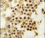 GDF3 Antibody in Immunohistochemistry (IHC)