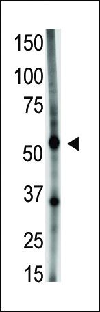 GDF5 Antibody in Western Blot (WB)