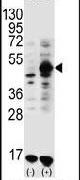 GDF9 Antibody in Western Blot (WB)