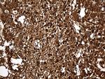 GDI1 Antibody in Immunohistochemistry (Paraffin) (IHC (P))