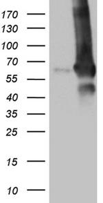 GDI1 Antibody in Western Blot (WB)