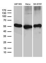 GDI1 Antibody in Western Blot (WB)