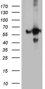 GDI1 Antibody in Western Blot (WB)