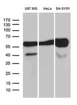 GDI1 Antibody in Western Blot (WB)