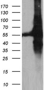 GDI1 Antibody in Western Blot (WB)