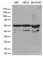 GDI1 Antibody in Western Blot (WB)