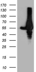 GDI1 Antibody in Western Blot (WB)