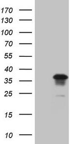 GEMIN2 Antibody in Western Blot (WB)