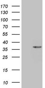 GEMIN2 Antibody in Western Blot (WB)
