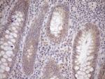 GEMIN8 Antibody in Immunohistochemistry (Paraffin) (IHC (P))