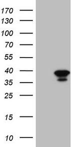 GEMIN8 Antibody in Western Blot (WB)