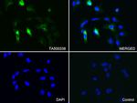 GFAP Antibody in Immunocytochemistry (ICC/IF)